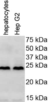 Hmgb1 Hmg 1 Antibody Nb100 2322 Novus Biologicals