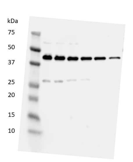 Hmgb1 Hmg 1 Antibody Nb100 2322 Novus Biologicals