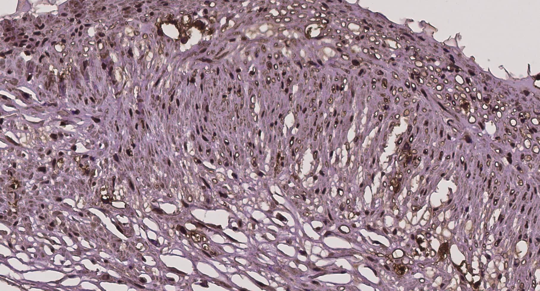 Hmgb1 Hmg 1 Antibody Nb100 2322 Novus Biologicals