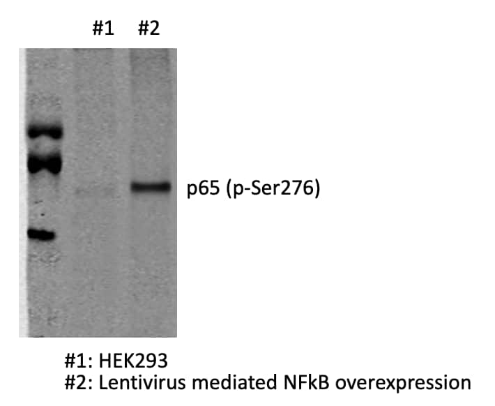 Western blots show p65 antibodies that passed the test of specificity