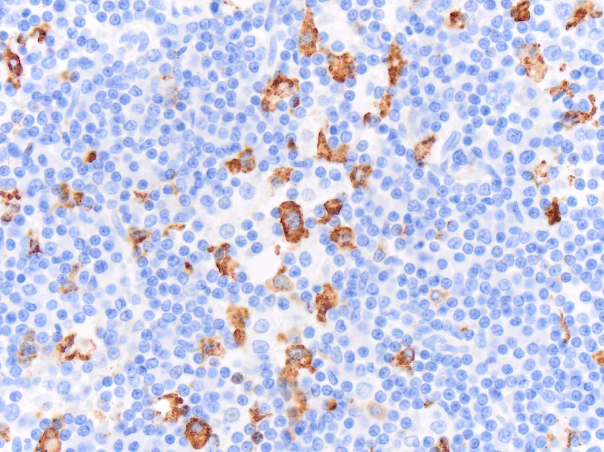 CD163 Antibody (EDHu-1) - BSA Free (NB110-40686): Novus