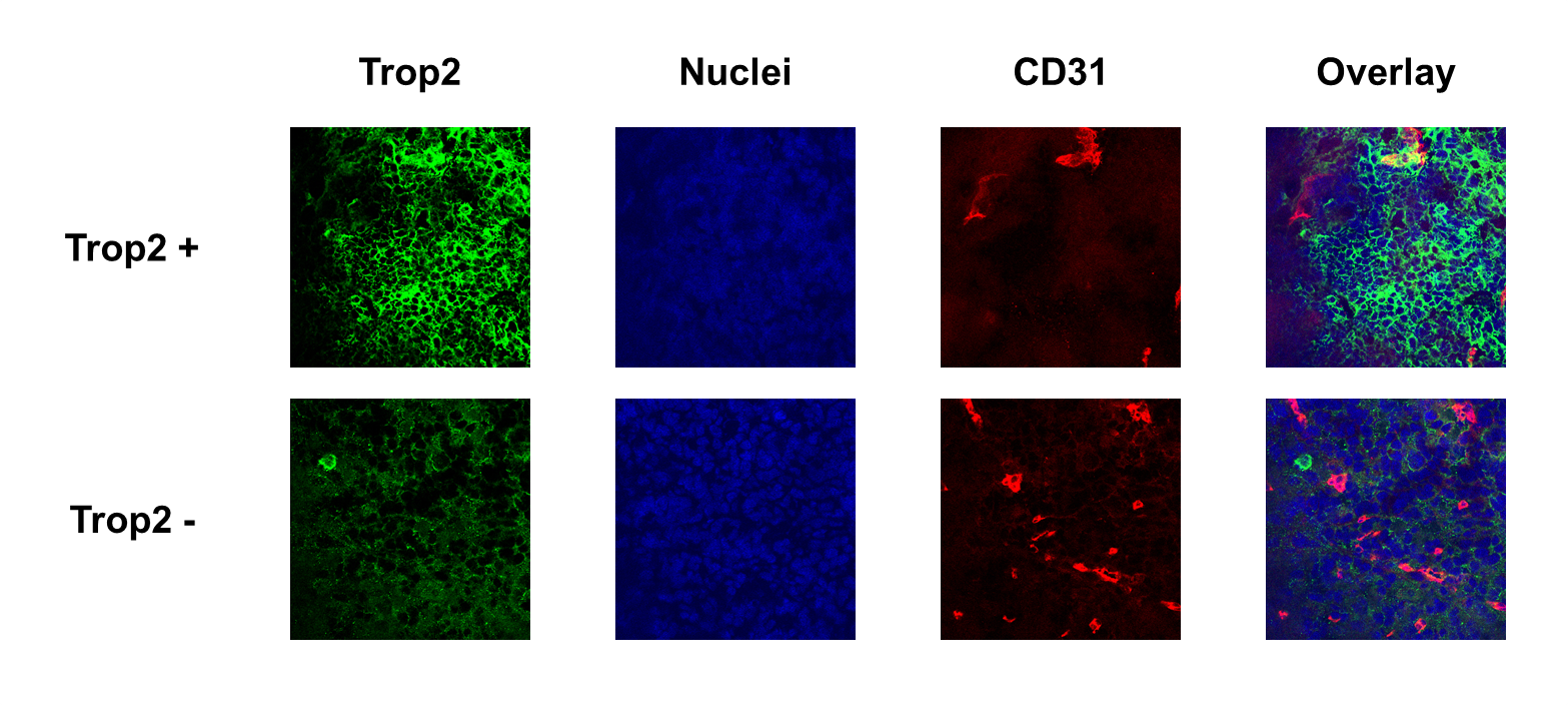 Immunohistochemistry-Frozen TROP-2 NBP1-92533
