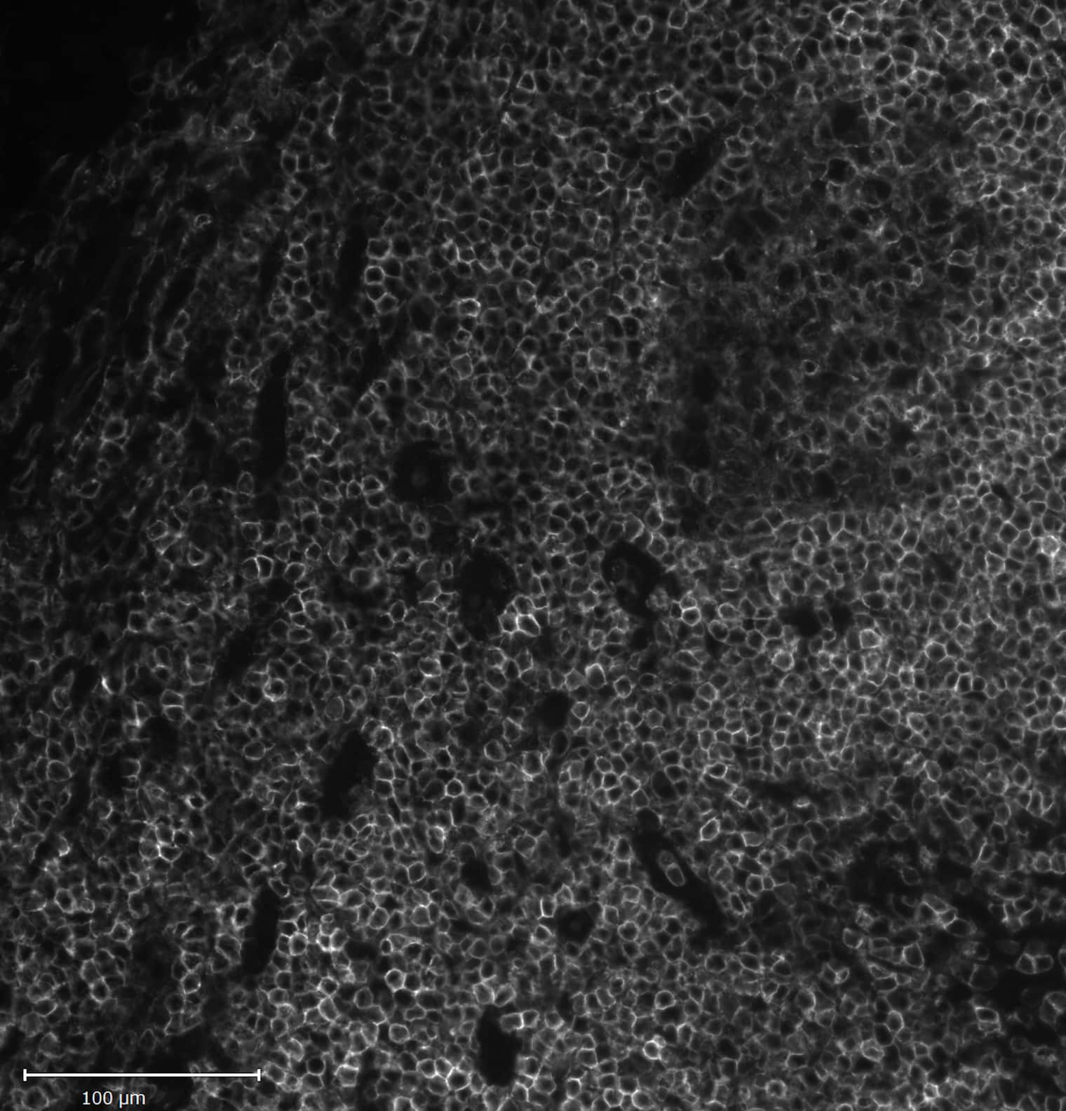 CD45 Antibody (2B11 + PD7/26) - Azide and BSA Free (NBP2