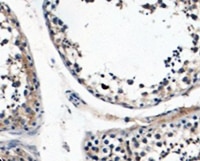 Immunohistochemistry-Paraffin Nuclear Antigen NBP2-45273