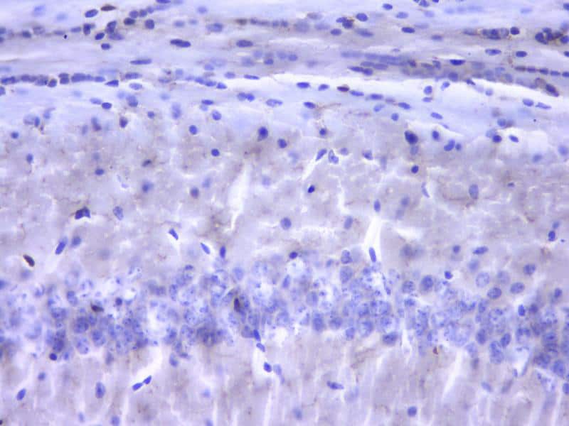 AIF-1/Iba1 Antibody (JM36-62) (NBP2-75397): Novus Biologicals