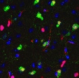 Immunohistochemistry-Frozen FABP3/H-FABP NBP2-75485